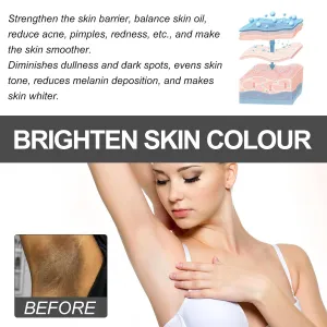 2025 new Crema Para Manchas Oscuras En La Cara,1/2/3pcs 30ml crema Para Las Manchas De La Cara,Para Piel Entrepierna, Manchas Codos, Piernas Zonas,Rodillas Cuello (2pcs)