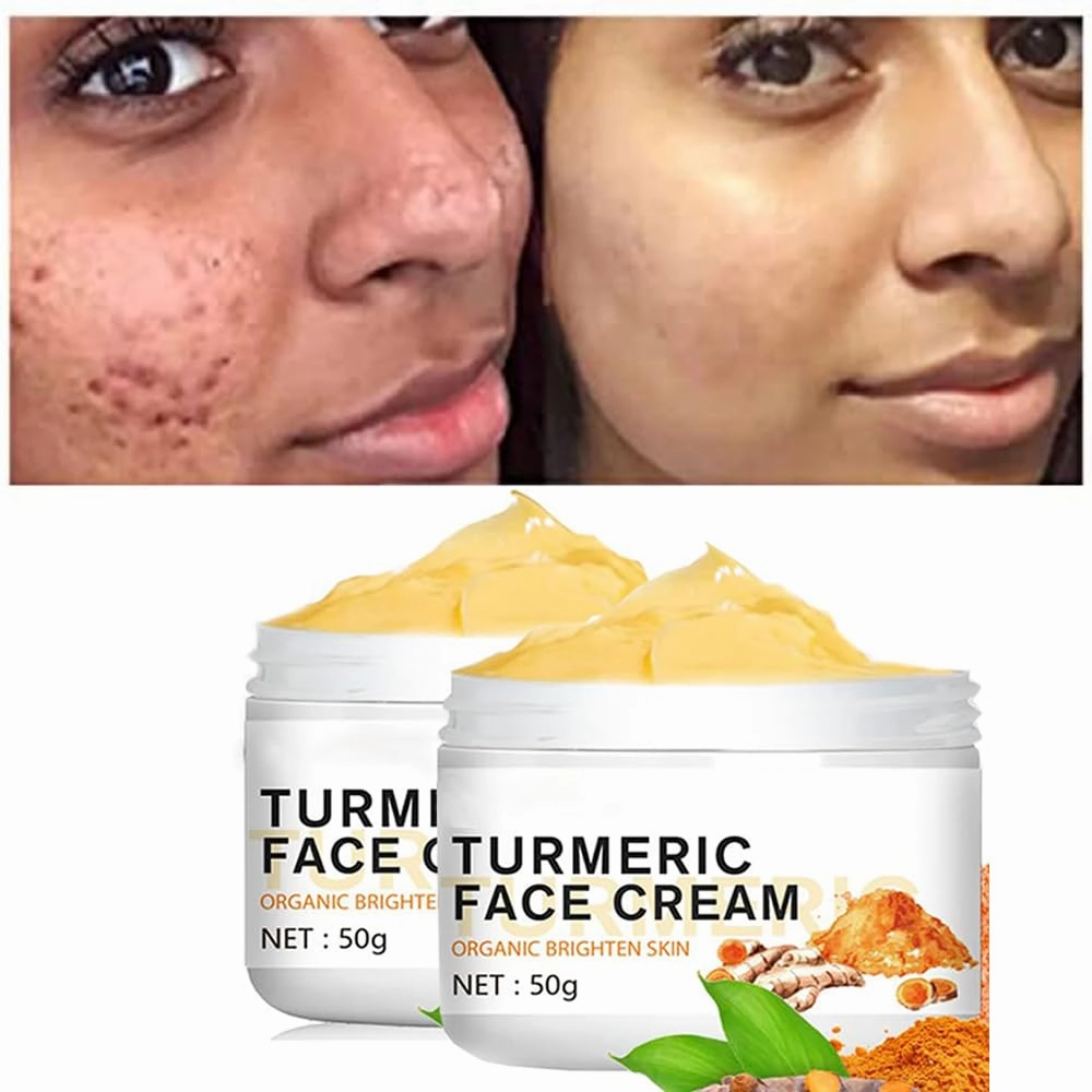 2PCS Turmeric Cream for Face, Anti-Aging Cream Facial Moisturizer Cream with Organic Ingredients, Skin Moisturizing Brightening Repair Cream for Dull Dry Skin