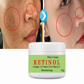 3PCS Cremas Para Las Manchas de La Cara, 50G Vitamin C&E Face Moisturizer Cream,Crema para manchas oscuras en la cara, Adecuado para varias áreas como cara, axilas, cuello, zona privade