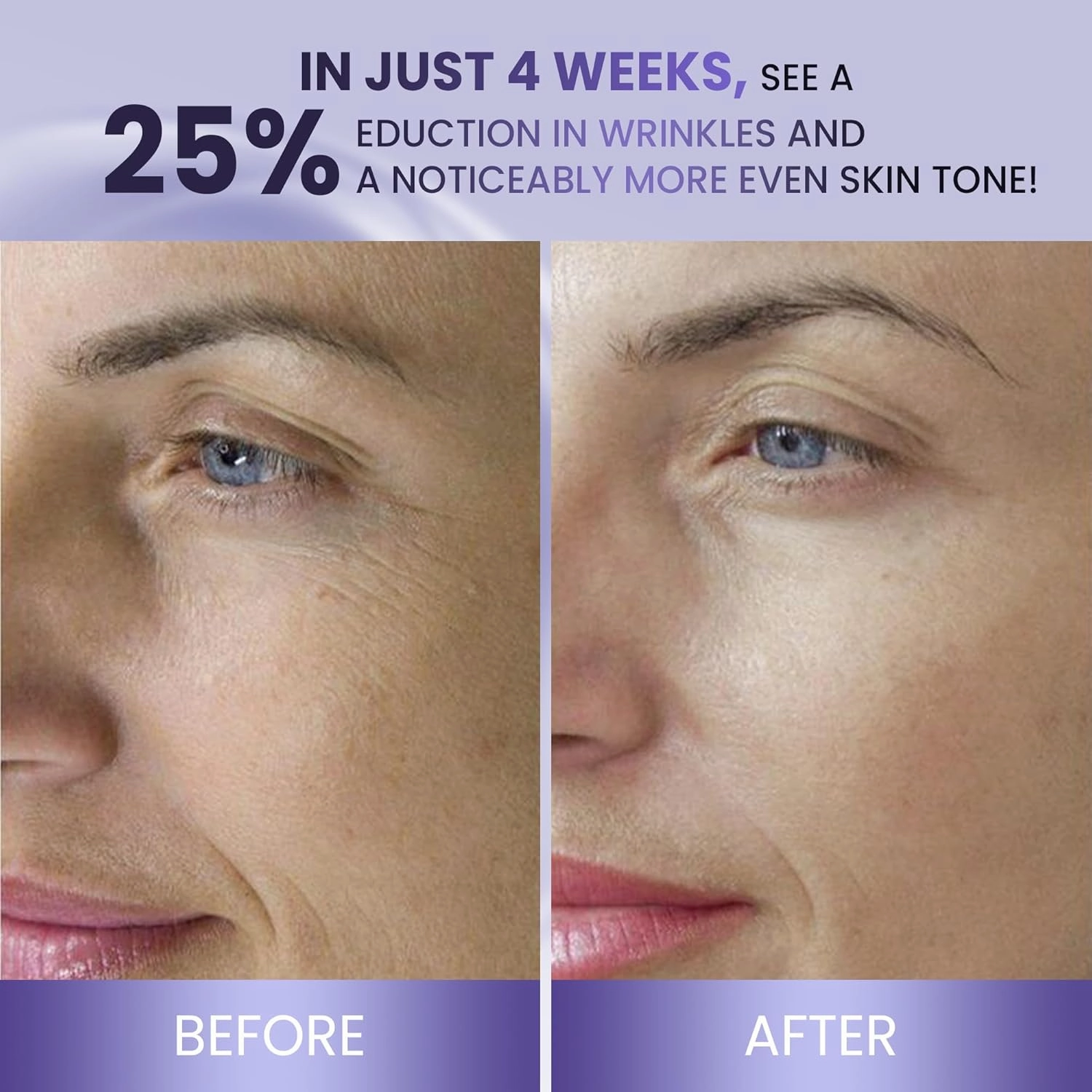 ABERA BELANI Retinol Night Cream For Women, Dark Spot Remover, Melasma Treatment, Reduce Fine Lines, Anti-Wrinkle, Anti-Aging Neck and Décolleté For Face (1 Box   Gift Eyelash Serum)