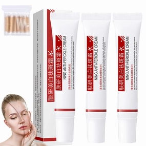 Aimierbuy Brightening Freckle Cream, Fuyan Anti-Freckle Cream, Aimierbuy Face Cream, Aimierbuys Moisturizer, Hydrating and Moisturizing, Balances Skin Moisture for All Skin Types