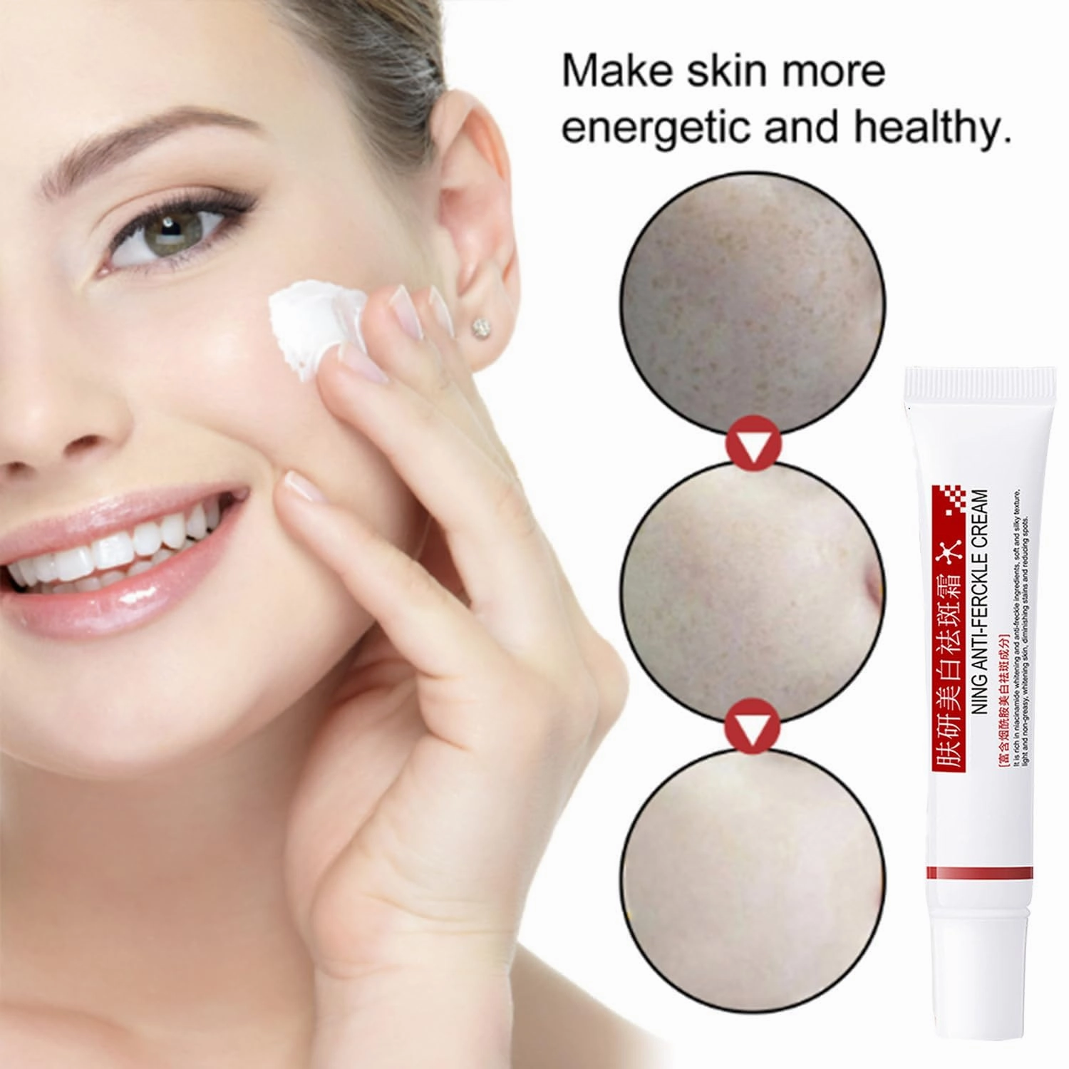 Aimierbuy Brightening Freckle Cream, Fuyan Anti-Freckle Cream, Aimierbuy Face Cream, Aimierbuys Moisturizer, Hydrating and Moisturizing, Balances Skin Moisture for All Skin Types