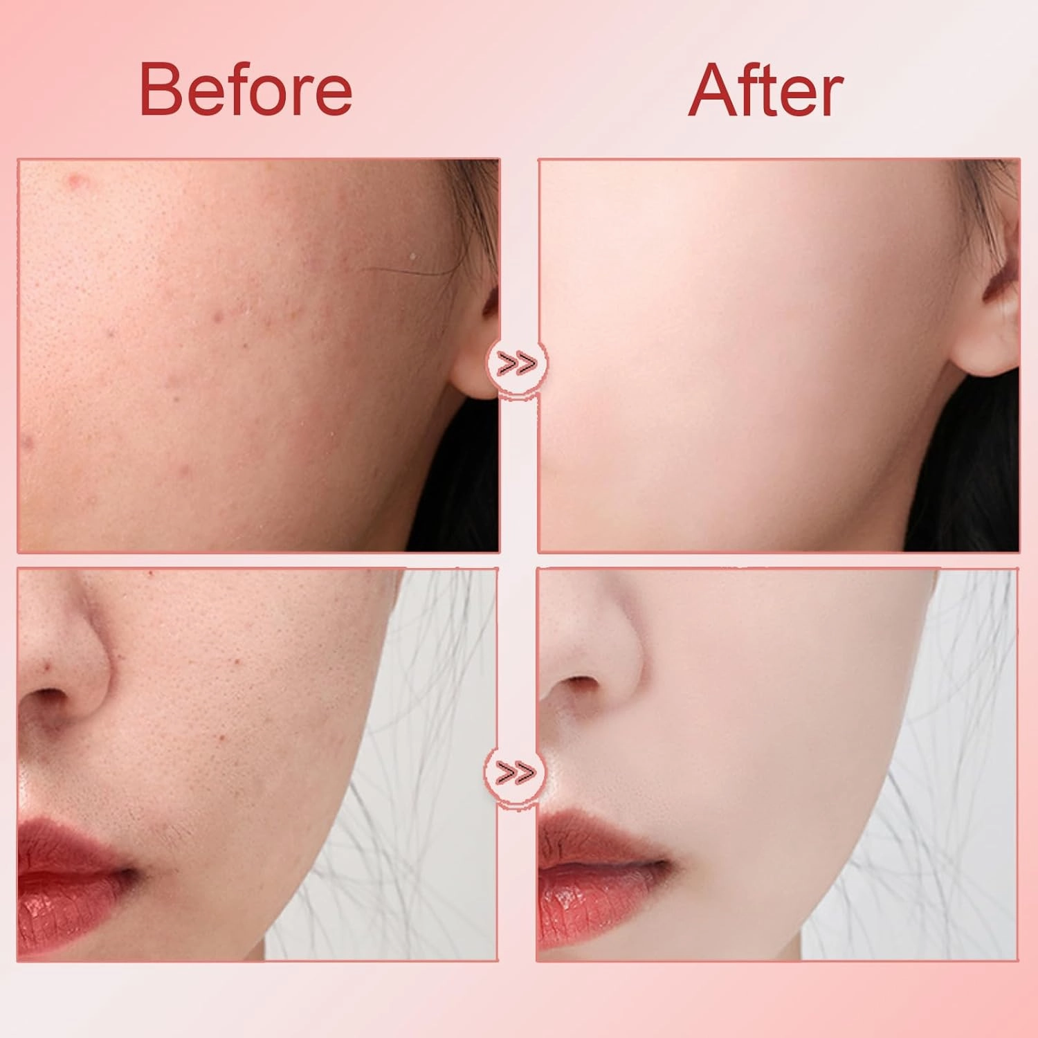 Aimierbuy Whitening Freckle Cream, Fuyan Whitening and Anti-Freckle Cream, Chinese Herbal Ingredients, Lightens Spots, Whitenings Moisturizer Skin Renewing for Men and Women (2pcs, 1)