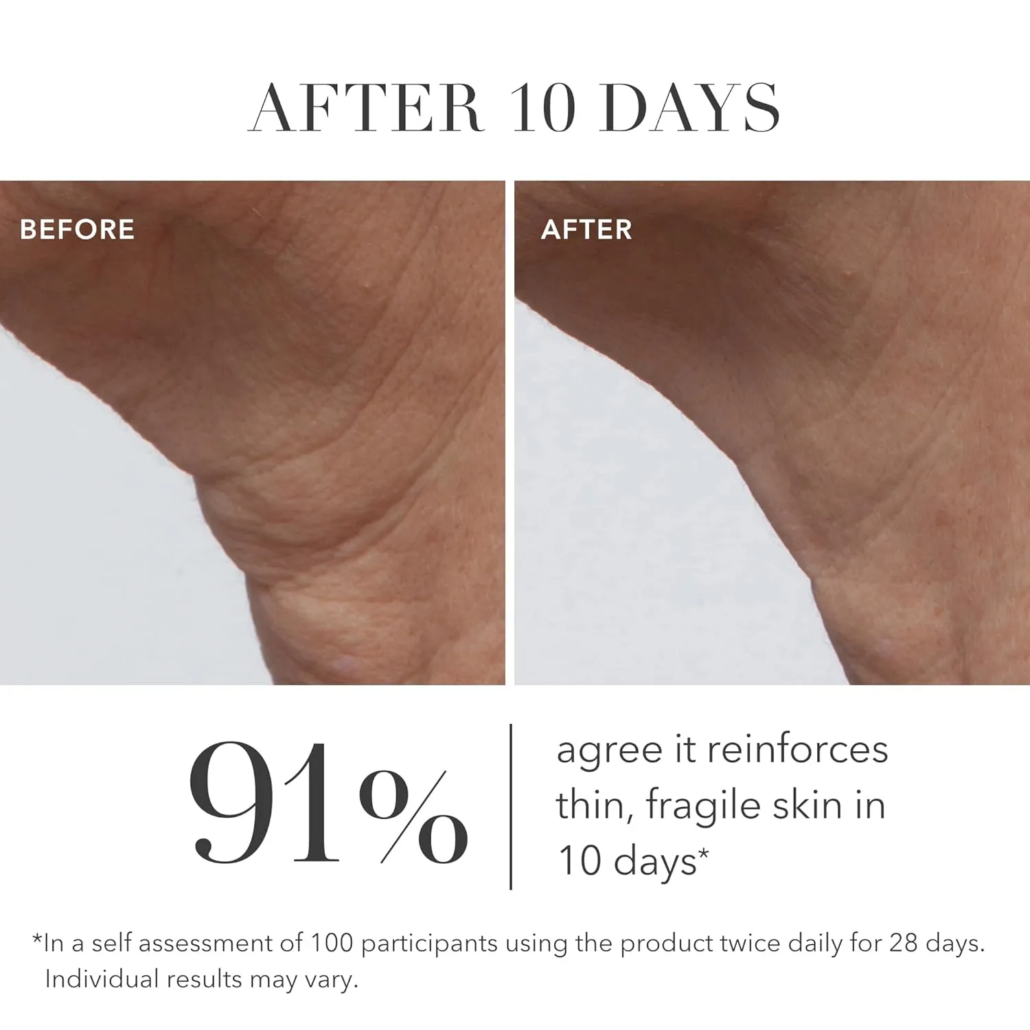 Algenist GENIUS Ultimate Anti-Aging Cream - Vegan Firming & Smoothing Moisturizer with Alguronic Acid & Microalgae Oil - Non-Comedogenic & Hypoallergenic Skincare