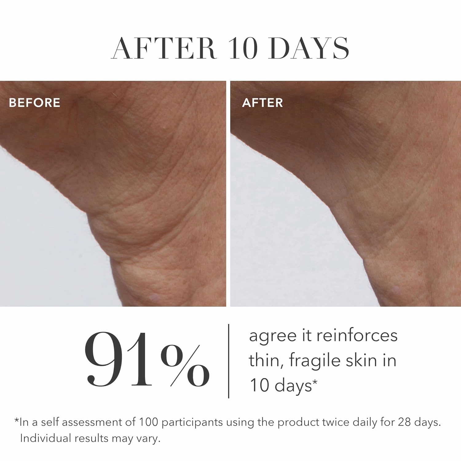 Algenist GENIUS Ultimate Anti-Aging Cream - Vegan Firming & Smoothing Moisturizer with Alguronic Acid & Microalgae Oil - Non-Comedogenic & Hypoallergenic Skincare