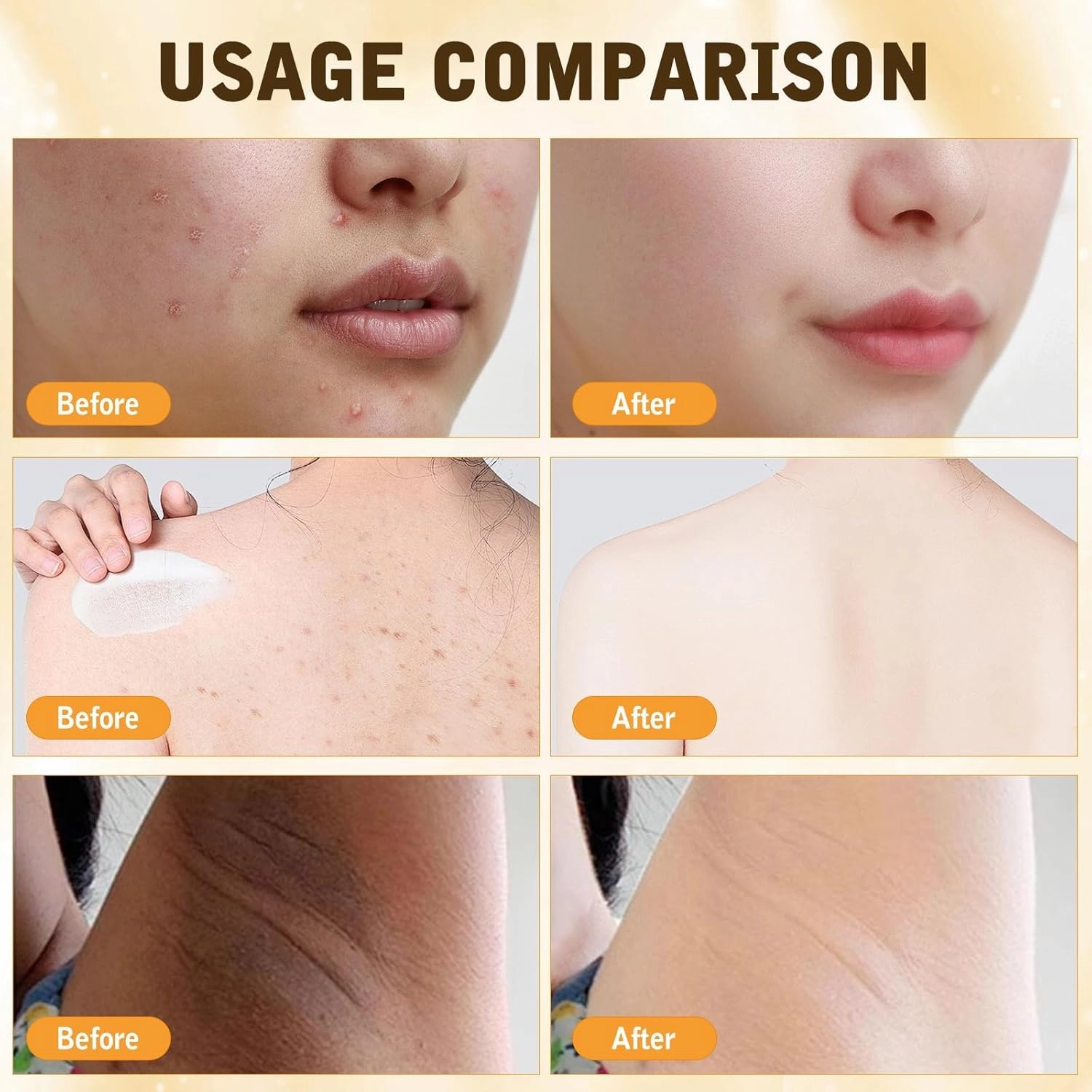 Bee Venom Comprehensive Cream, 2025 New Bee Venom Skin Treatment Cream-50g, Advanced Firming & Wrinkle-Reducing cream Natural Skin Moisturizer for All Skin (2)
