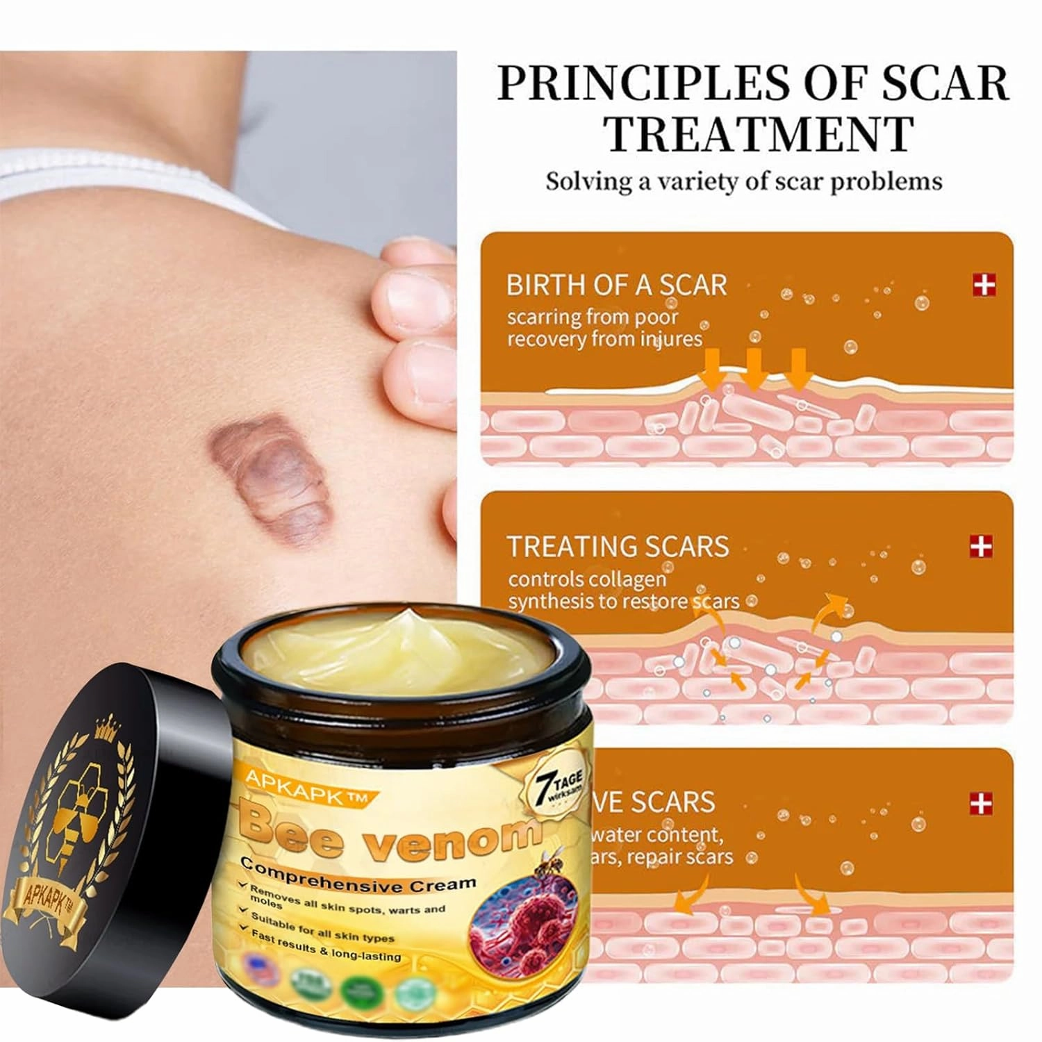 Bee Venom Comprehensive Cream, 2025 New Bee Venom Skin Treatment Cream, Bee Venom Cream-50g, Natural Skin Moisturizer for All Skin Types (3)