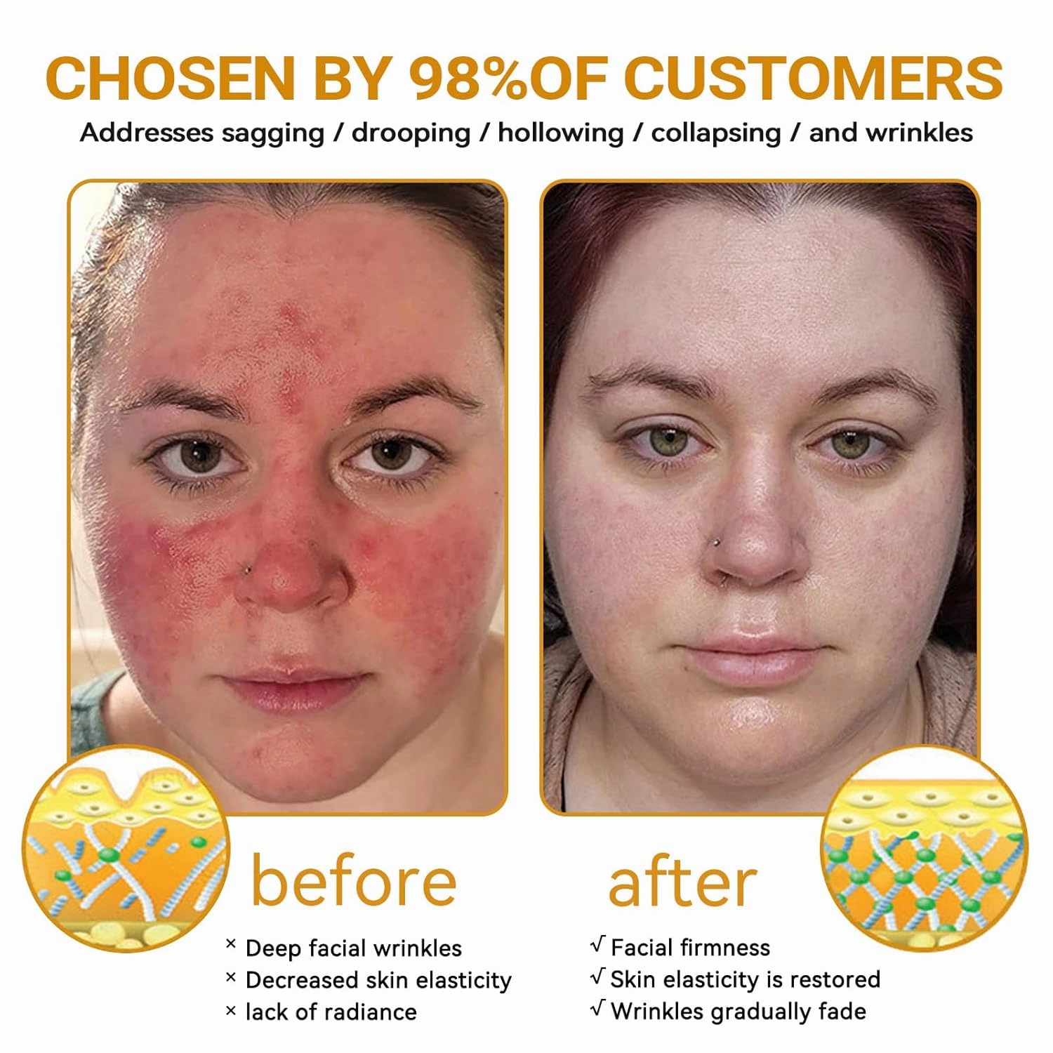 Bee Venom Skin Restoration Cream, Bee Venom Skin Treatment Cream for Face & Body, Bee Venom cream for Women & Men - Day & Night Use (4)