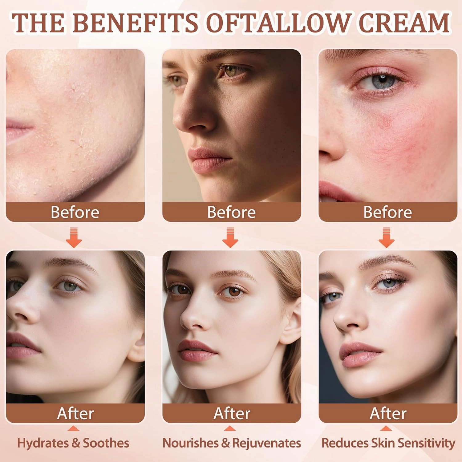 Beef Tallow for Skin, Whipped Tallow Cream for Face Moisturizer, 100% Grass Fed, Deeply Nourishing for Body, Smooth Soft for Dry Skin (Honey)