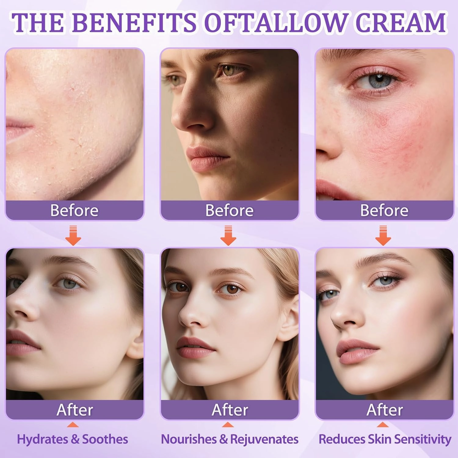 Beef Tallow for Skin, Whipped Tallow Cream for Face Moisturizer, 100% Grass Fed, Deeply Nourishing for Body, Smooth Soft for Dry Skin (Lavender)