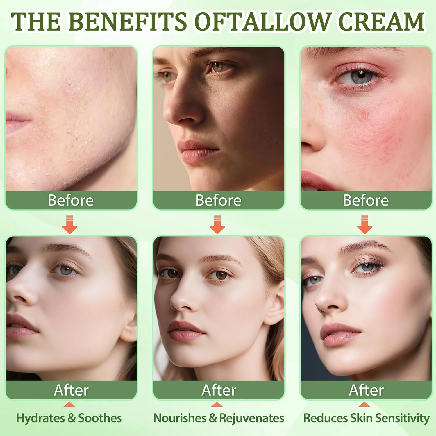 Beef Tallow for Skin, Whipped Tallow Cream for Face Moisturizer, 100% Grass Fed, Deeply Nourishing for Body, Smooth Soft for Dry Skin (Vanilla)