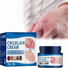 Chilblain Cream, Anti-cracking Frostbite Moisturiser Deep Nourishing, Anti Crack & Hand Foot Cream, Foot Repair Cream, for Dry Cracked Heels Callus Remover (3 Pcs)
