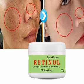 Cremas Para Las Manchas de La Cara 50G, Crema Para Manchas Oscuras En La Cara,Vitamin C&E Face Moisturizer Cream, Adecuado para varias áreas como cara, axilas, cuello, zona privada