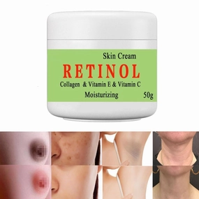 Cremas Para Las Manchas de La Cara, 50g Vitamin C&E Face Moisturizer Cream, Adecuado para varias áreas como cara, axilas, cuello, zona privade
