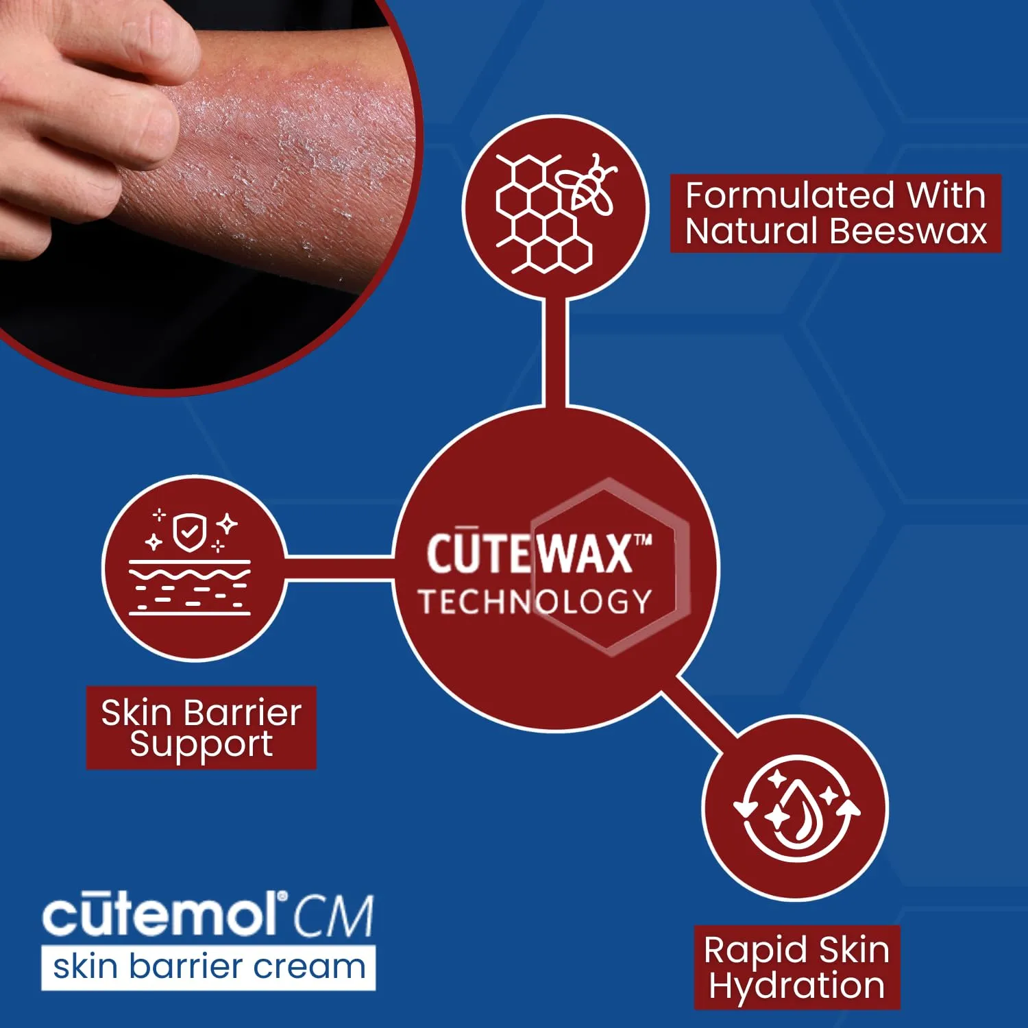 Cutemol CM Emollient Moisturizing Cream - For Severely Dry and Damaged Skin - Natural Beeswax Formulation containing Ceramides - Hydration for Cracked Hands and Feet, Eczema, Psoriasis (8 oz)