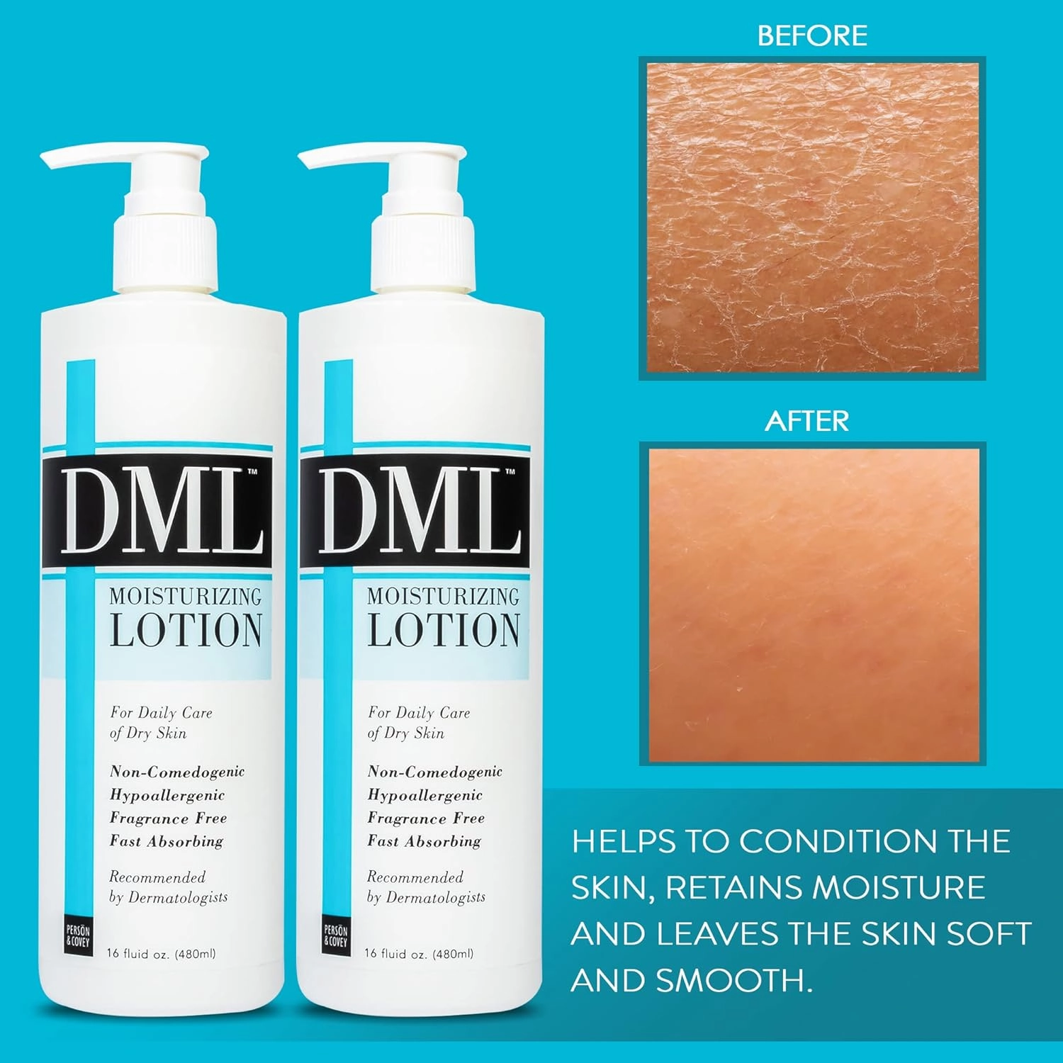 DML Moisturizing Lotion- Hydrating Hand and Body Moisturizer / Hypoallergenic Body Lotion for Dry and Cracked Skin / Gentle, Unscented Moisturizing Lotion Great for Men and Women / 16 oz (Pack of 2)