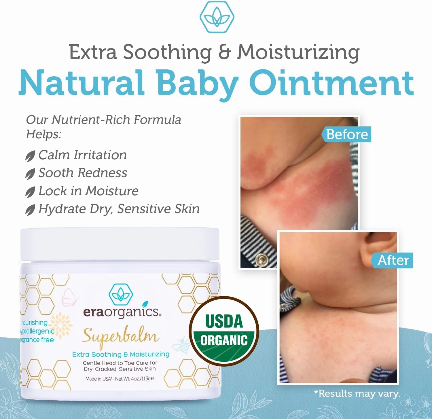 Era Organics Healing Ointment for Babies - USDA Certified Organic Natural Gentle Moisturizer for Sensitive Skin Prone To Baby Eczema, Cradle Cap (Infant Seborrheic Dermatitis), Rashes & Hives (4 oz.)