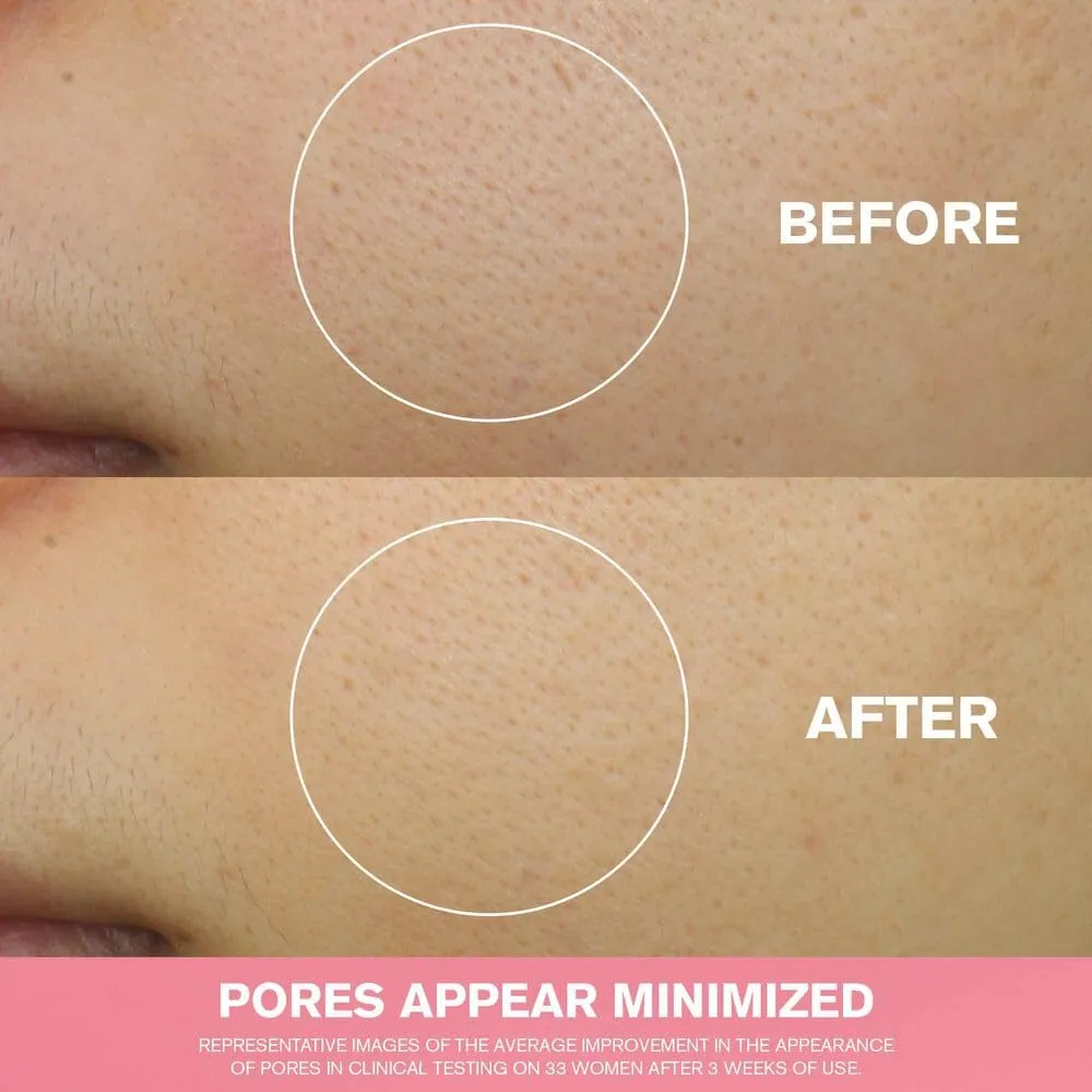 Estée Lauder Nutritious Melting Soft Cream Moisturizer/Face Mask with Niacinamide | Pore Minimizing