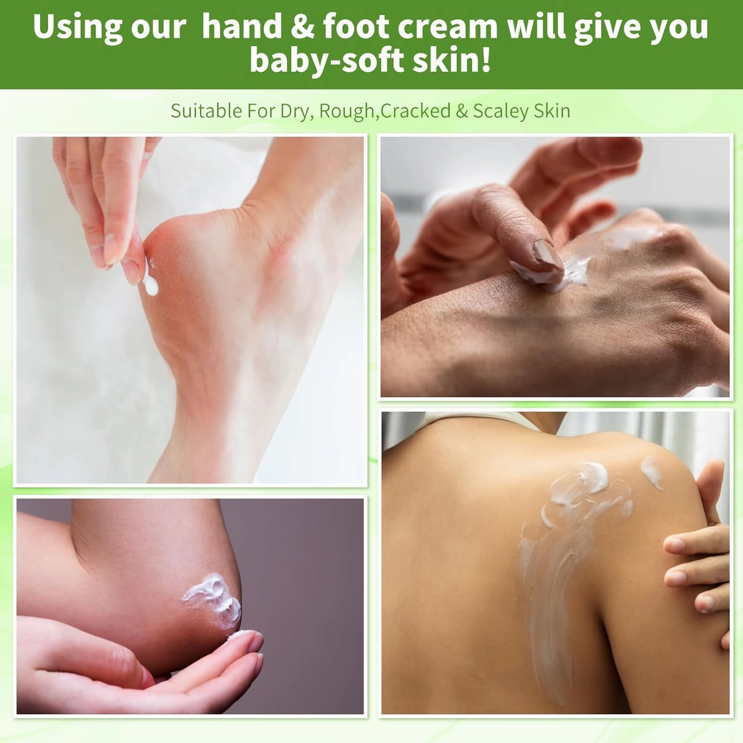 Foot Callus Remover, Hand & Foot Cream, Lotion for Extremely Dry Skin, Athletes Foot Treatment, Pedicure Foot Spa Products for Dry Hands, Cracked Feet, Rough and Dry Skin, 250ml Jasmine