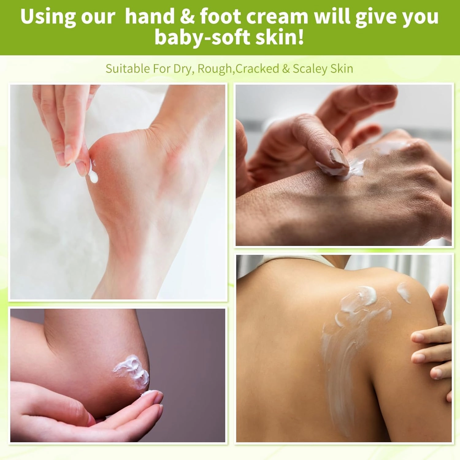 Foot Callus Remover, Hand & Foot Cream, Lotion for Extremely Dry Skin, Athletes Foot Treatment, Pedicure Foot Spa Products for Dry Hands, Cracked Feet, Rough and Dry Skin, 250ml Lemon