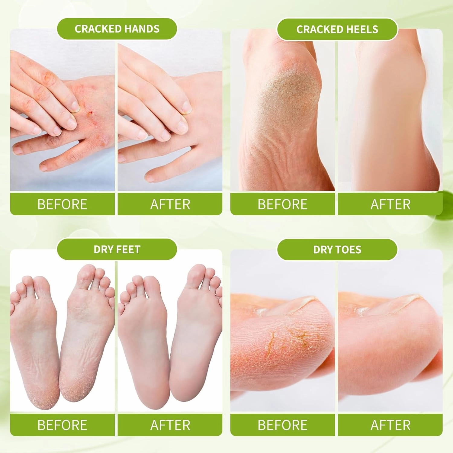 Foot Callus Remover, Hand & Foot Cream, Lotion for Extremely Dry Skin, Athletes Foot Treatment, Pedicure Foot Spa Products for Dry Hands, Cracked Feet, Rough and Dry Skin, 250ml Lemon