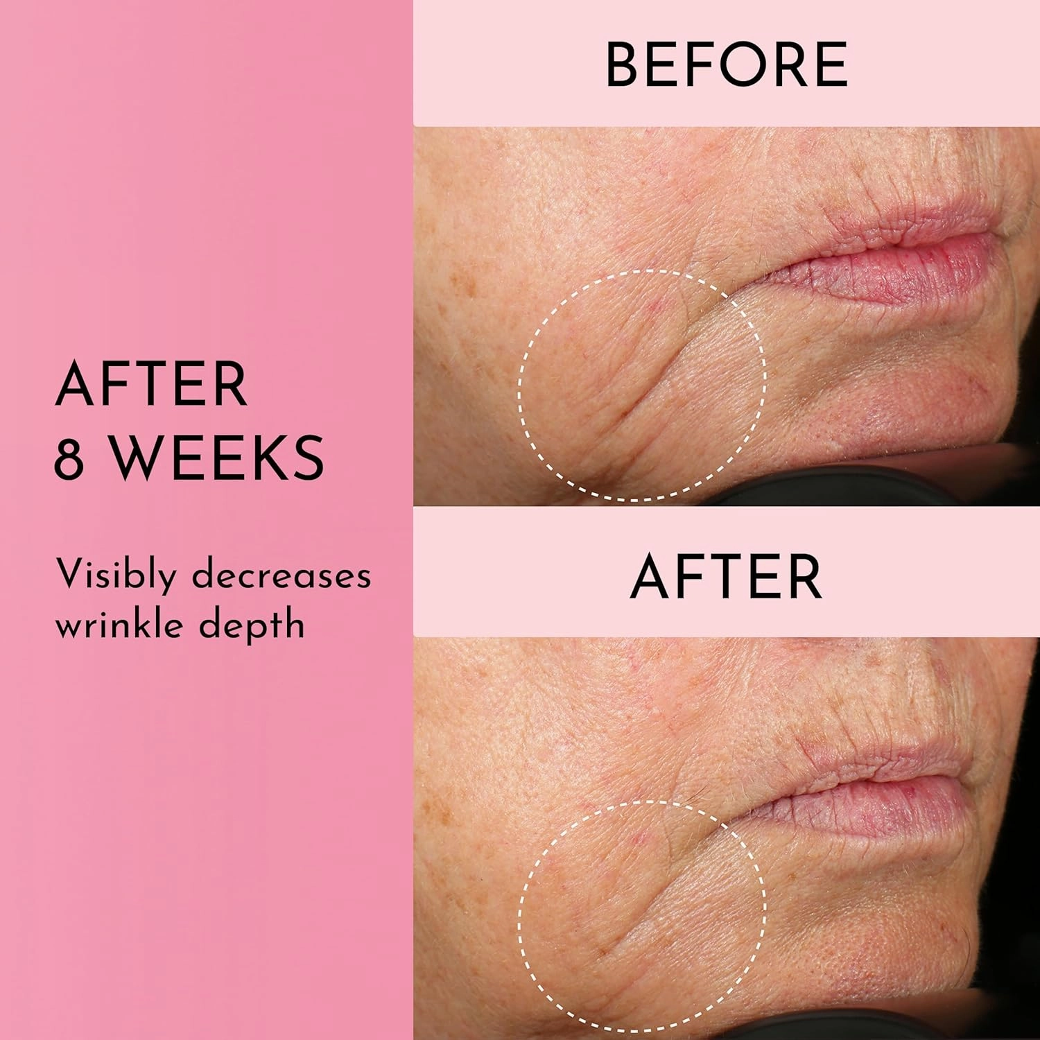 Forget the Filler Perfecting Cream