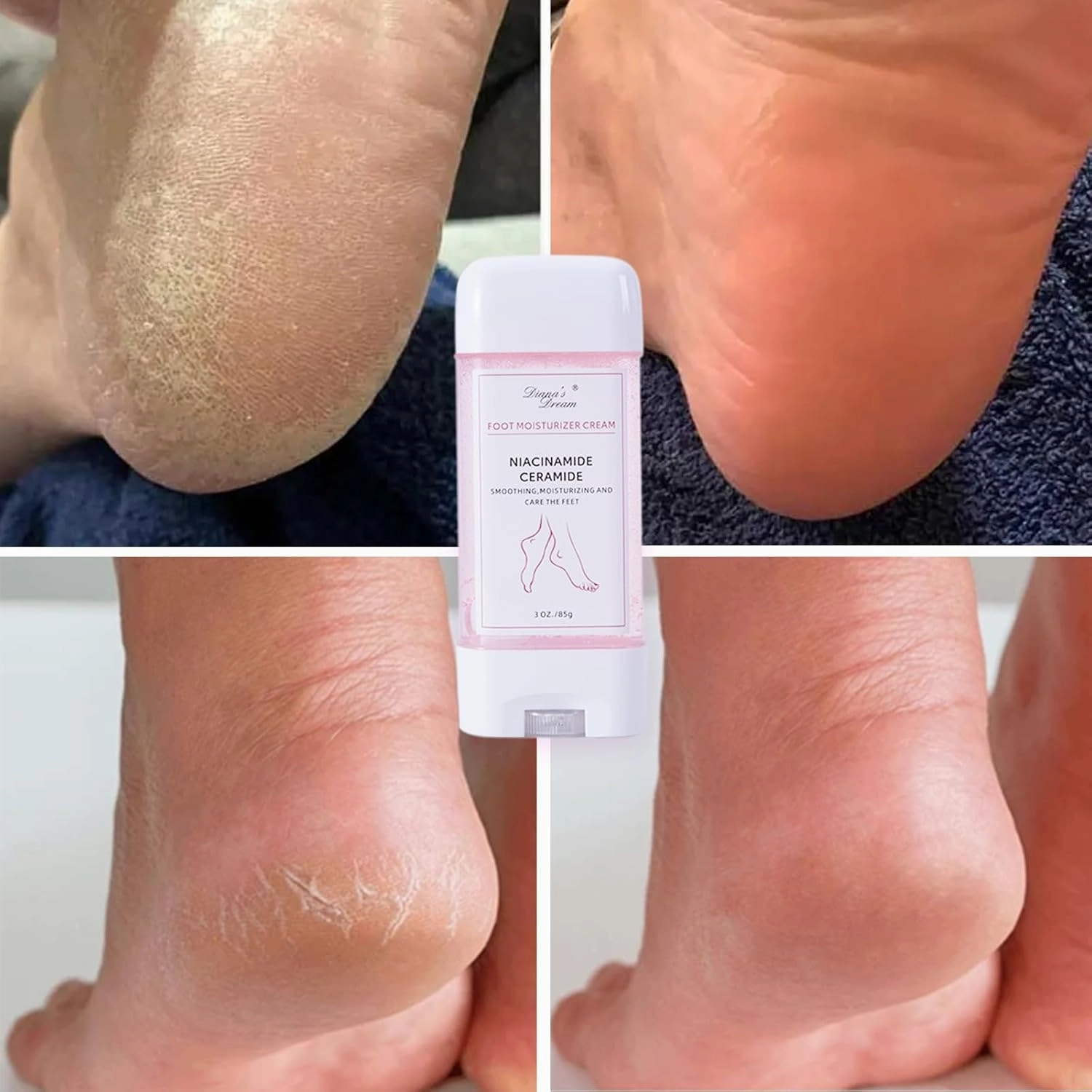 Hydrating and Anti-Cracking Foot Cream, 2025 New Moisturising and Relieves Cracking and Dryness Heel Cream, 3 OZ Foot Repair Cream for Calluses & Dry Feet, Gift for Mom Women Friend (2PCS, 3OZ)