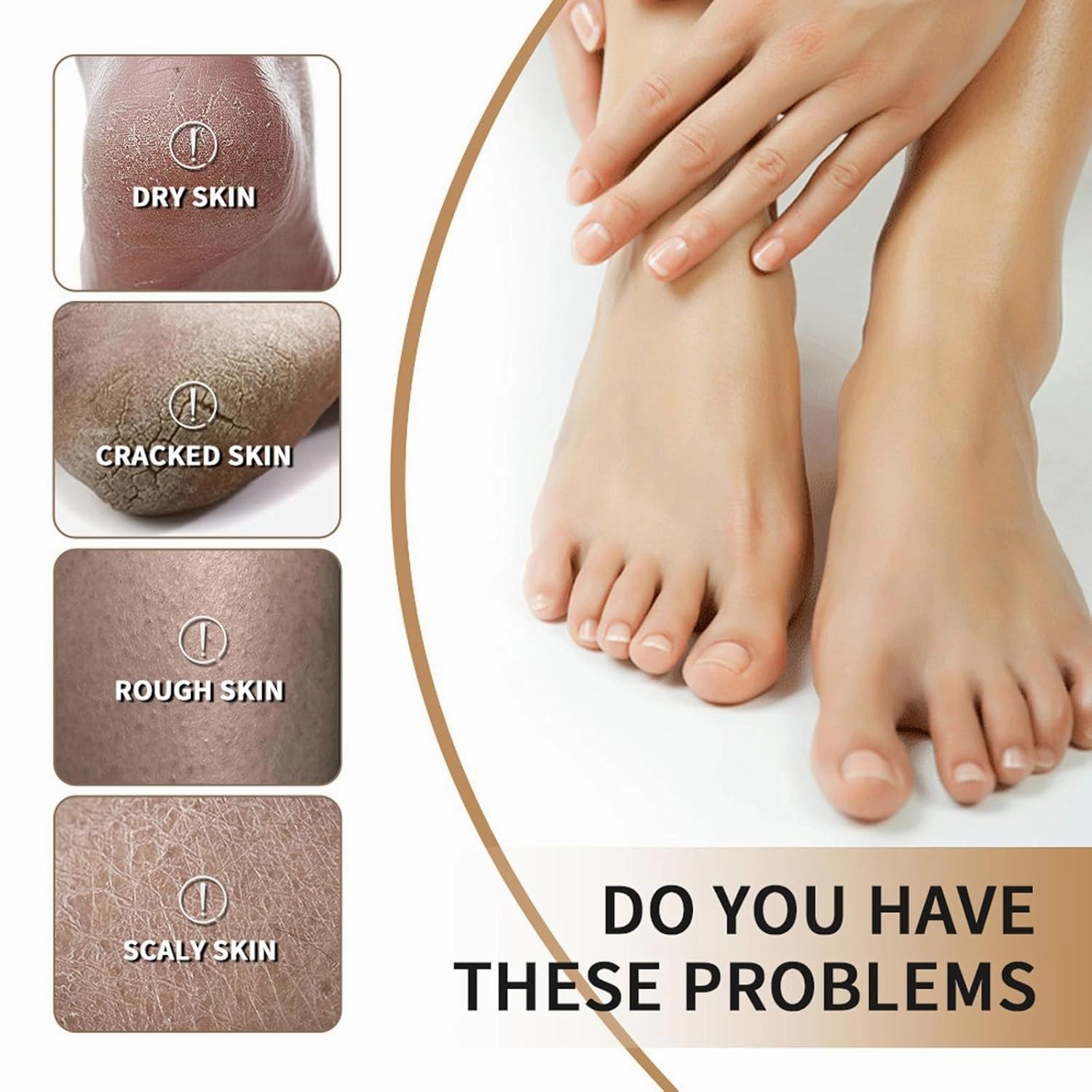 Hydrating Foot Cream, Heel Balm for Dry Cracked Feet, Intensive Foot Lotion with Shea Butter & Jojoba Oil for Cracked Heel Care, Foot Cream for Women Men Adult Teens (3pcs, 3.5 Oz)