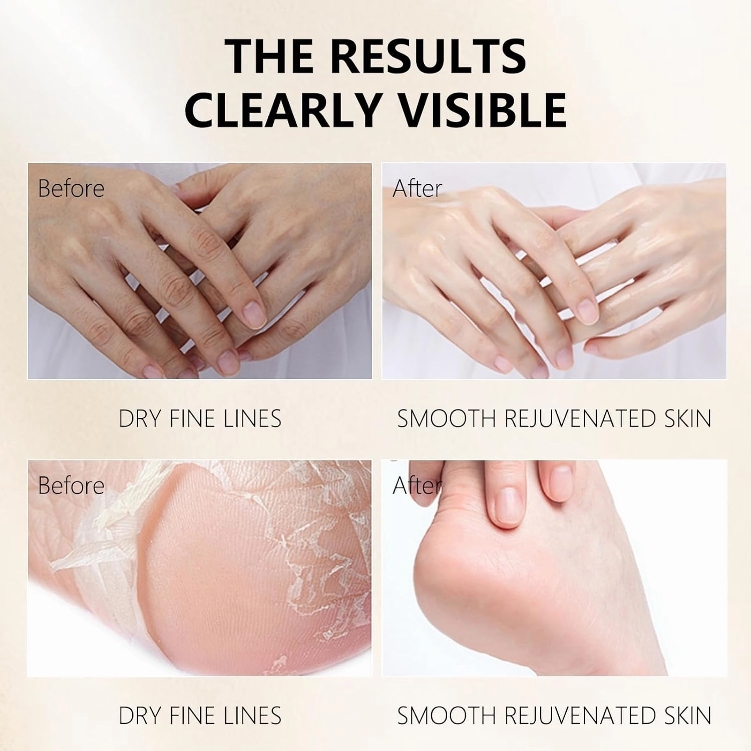 Hydrating Hand Foot Masks Set,Moisturizing Hand Mask for Dry Hand,Hydrating Foot Mask for Dry Cracked Feet,6 Pack Glove Mask & 6 Pack Socks Mask for Women（Milk）