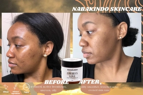 Liberian Love Face and Body Moisturizer by Nabakindo Skincare | Ideal for Sensitive Skin and Eczema (2oz)