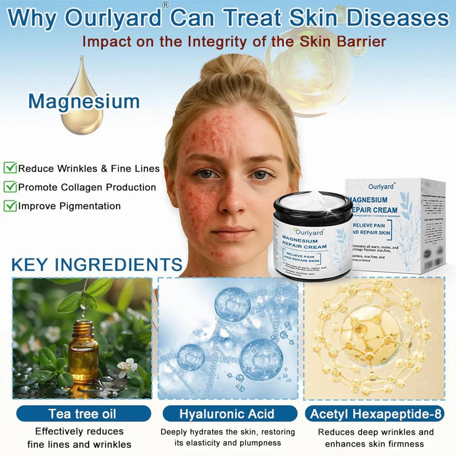 Magnesium Skin Repair Cream,2025 New Skin Treatment Cream,Effectively improves skin texture and reduces blemishes (2PCS)