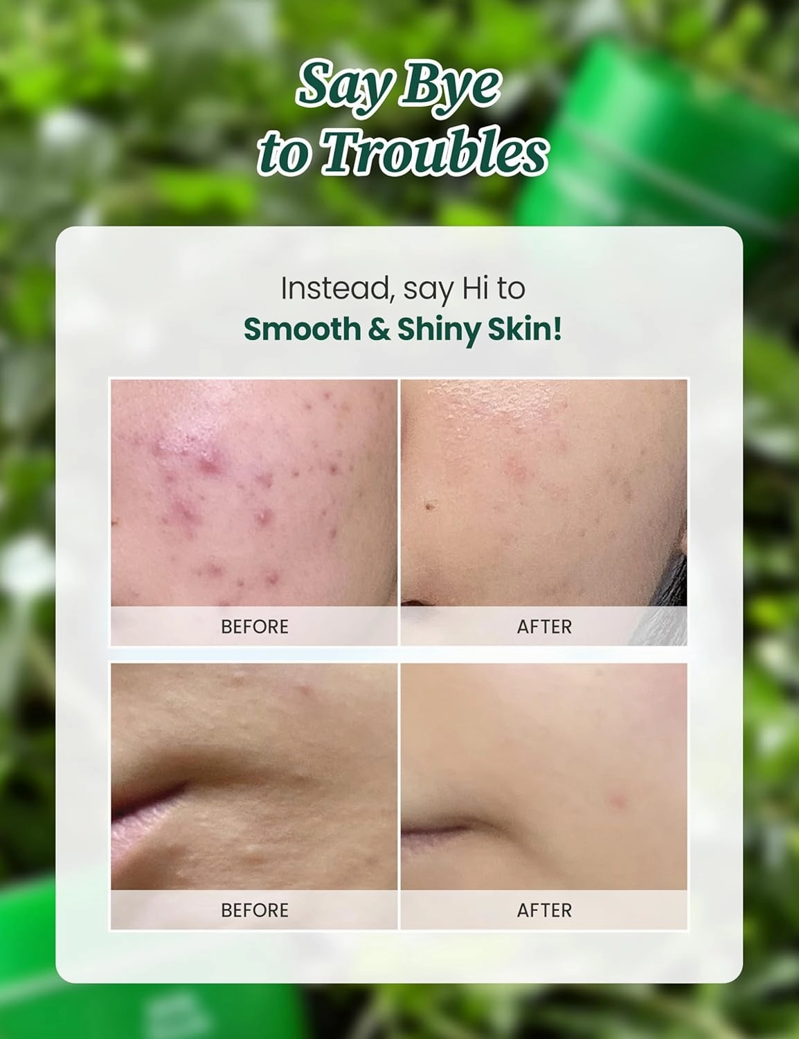 MILKTOUCH Hedera Helix Relaxing Cream Jumbo - Redness Relief Face Moisturizer, Hydrating & Calming Cream for Sensitive and Redness-Prone Skin with Hedera Helix, Cica Extract, Soothes Rosace 3.38 oz.