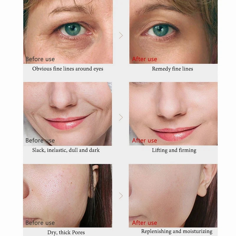 Moisturizer