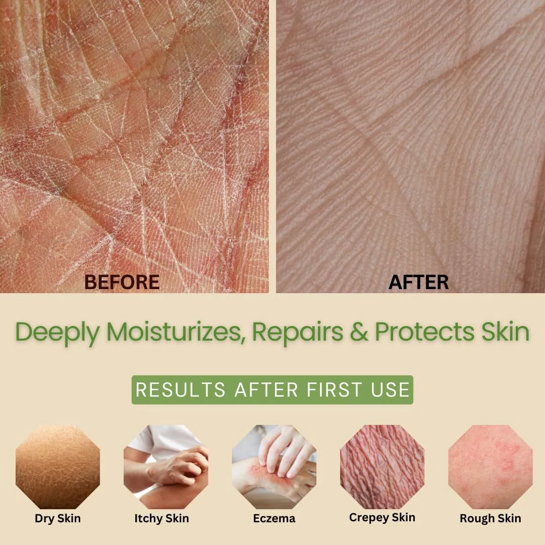 Moisturizing & Firming Lemongrass Body Lotion & Hand Cream - Natural Moisturizer for Dry Skin, Itchy or Crepey Skin - Eczema Treatment - Olive Oil, Coconut Oil & Avocado Oil - 8oz