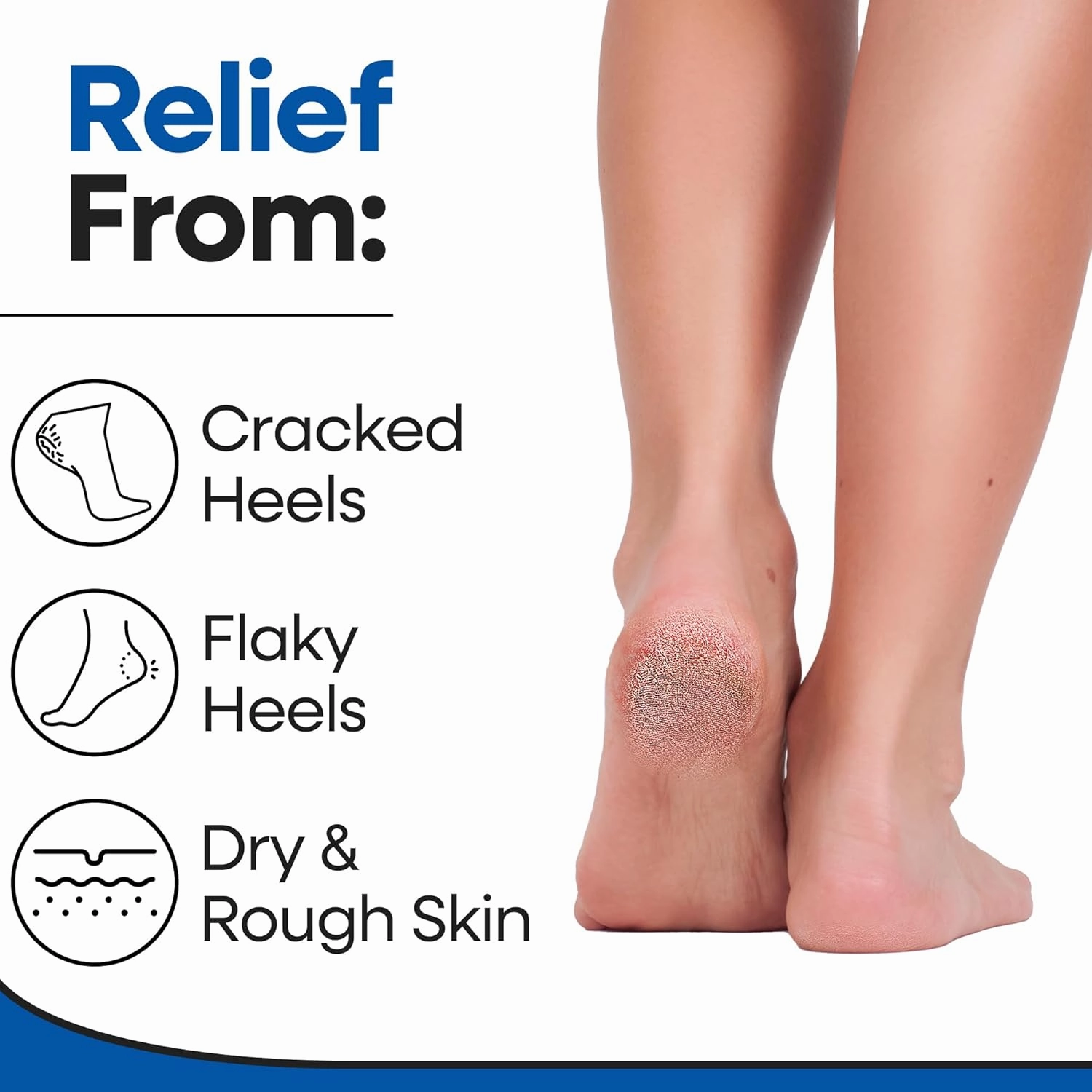 Moisturizing Socks for Men | Cracked Heel Treatment with Aloe Vera | Moisturizer Foot Callus Remover | Aloe Socks for Cracked Heels & Dry Cracked Feet | Lotion Infused Gel Heel Socks (XL - 3 Pairs)