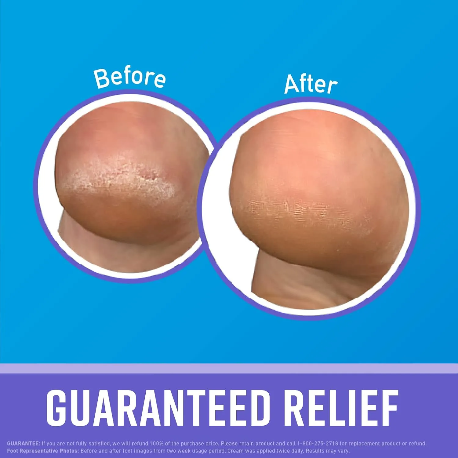 O'Keeffe's for Healthy Feet Night Treatment Foot Cream - 7 oz Tube (2 Pack) - Overnight Relief for Extremely Cracked, Dry Feet, Repairing Skincare, Instantly Boosts and Retains Moisture Levels