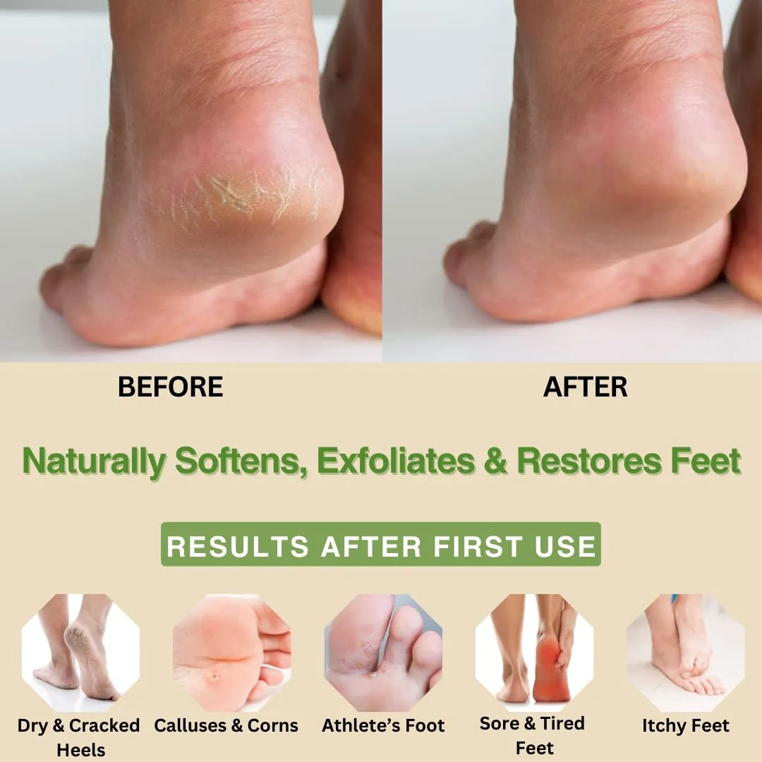 Peppermint, Rosemary & Eucalyptus Massage & Foot Cream for Dry Cracked Heels and Feet - Moisturizing Foot Lotion for Cracked Heel Repair - Callus Remover with Lactic Acid (4 oz)