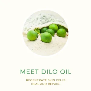 PURE FIJI Dilo and Aloe Vera After Sun Spray Lotion - Spray Moisturizer for Body Helps After Sunburn- After Sun Moisturizing Spray for All Type Skin, 8 oz