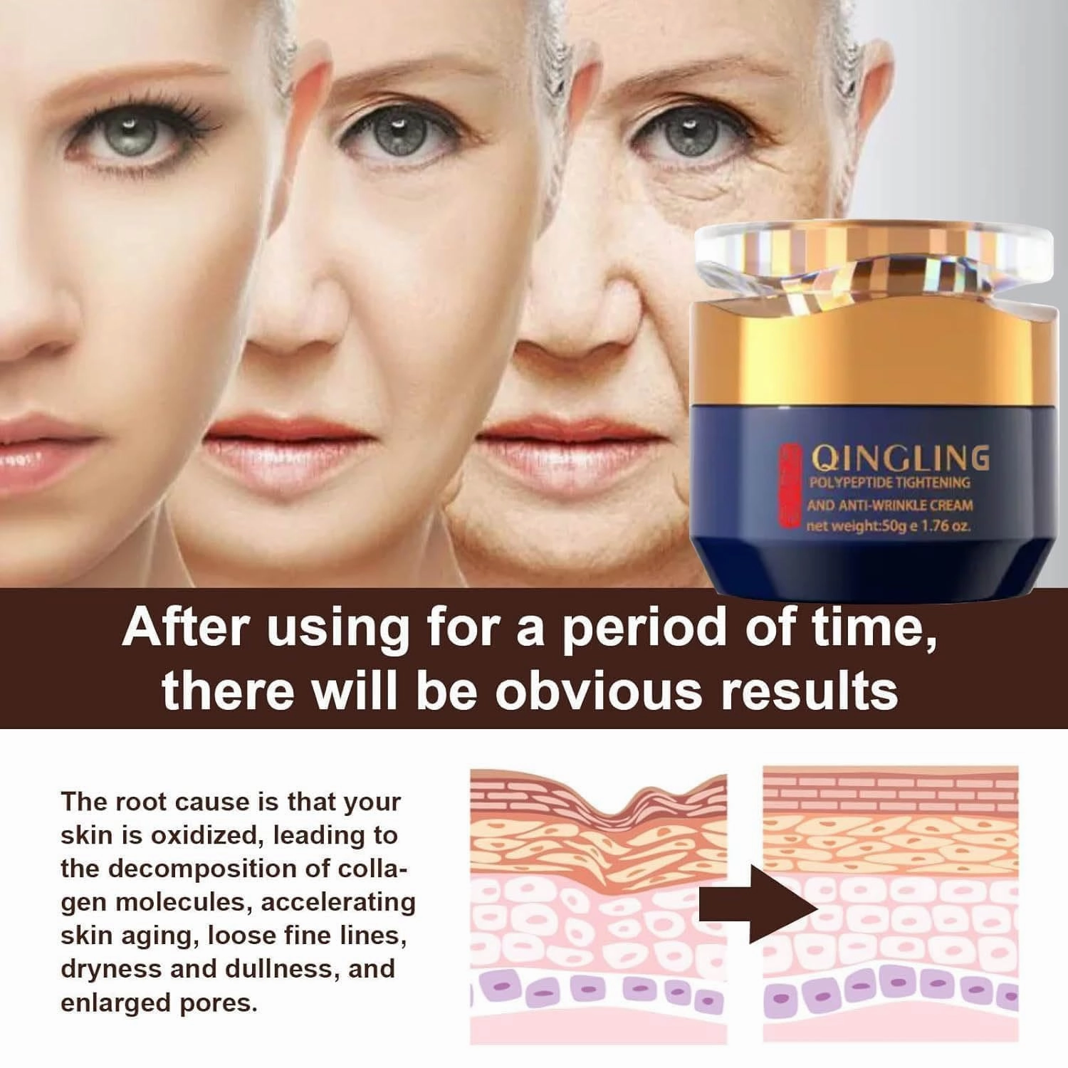 Qingling Crema Para Arrugas, Qingling Face Cream, Qingling Wrinkle Removal Cream, Polypeptide Tightening and Anti-Wrinkle Cream, Firming Anti-aging Eye Cream for Women Men (2)