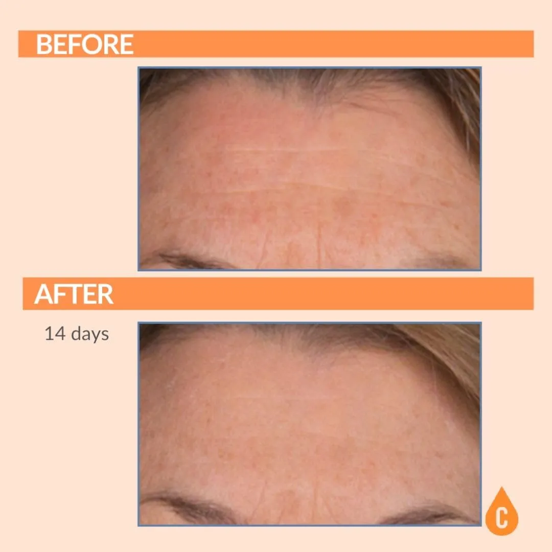 Serious Skincare - Vitamin C Face Cream for Women and Men - Hydrates Dry Skin - Anti-Aging Wrinkle Moisturizer for Radiant Skin - Vitamin C3 Esters - Hydrolyzed Collagen - Daytime SPF 30-2 Fl. Oz.